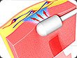 Illustrateur 3D Medical et Technique