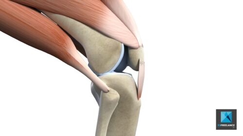 déchirure du tendon genoux - illustration médicale