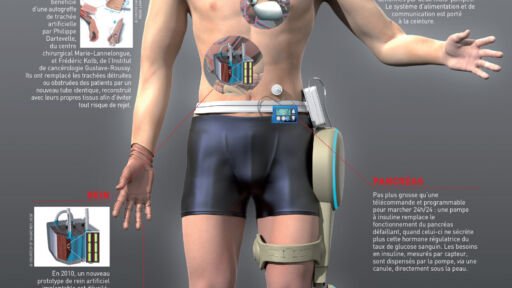 illustration scientifique - l'homme augmenté