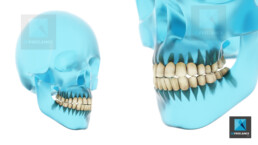 image 3d médicale dentition dents